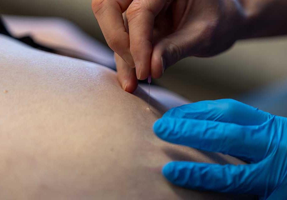 Dry-needling_ProVitaal-Meeden_CT-02 Dry-needling_ProVitaal-Meeden_CT-02